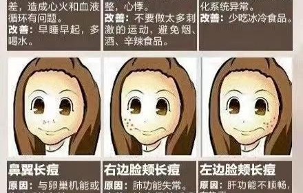 长痘痘的位置图解(脸上痘痘位置解说图)