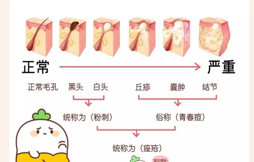 脸上长痘痘怎么办(熬夜脸上长痘痘怎么办)