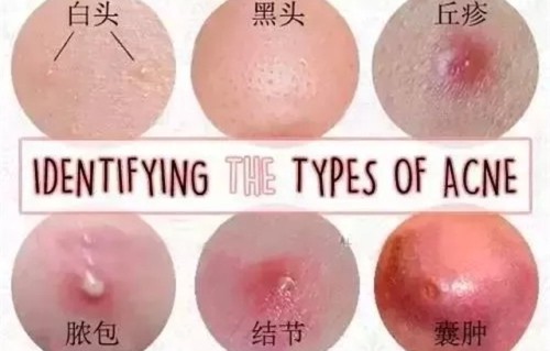 包含外阴长痘痘的词条