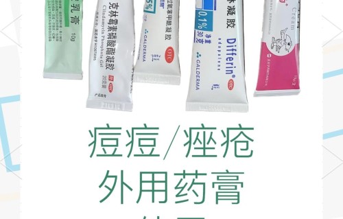 长痘痘涂什么药膏(屁股上长痘痘涂什么药膏)