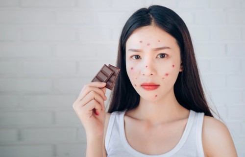 痘痘女孩(痘痘 女孩)