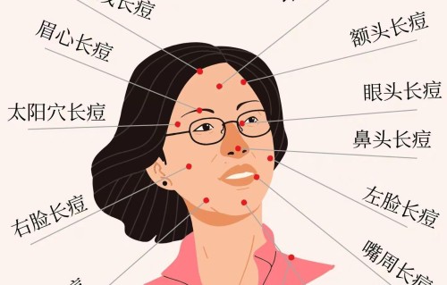 头上长痘痘怎么办(初中生头上长痘痘怎么办)