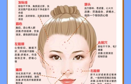 脸上有痘痘怎么办(脸上有痘痘怎么办用盐)