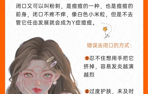 额头上长痘痘怎么消除(青少年额头上长痘痘怎么消除)