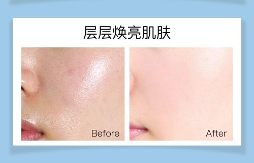 祛斑产品排行榜10强(真正有效的祛斑产品排行榜10强)