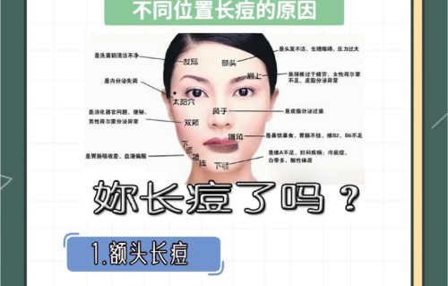 人中长痘痘是哪里的火(人中长痘对应身体哪个部位)