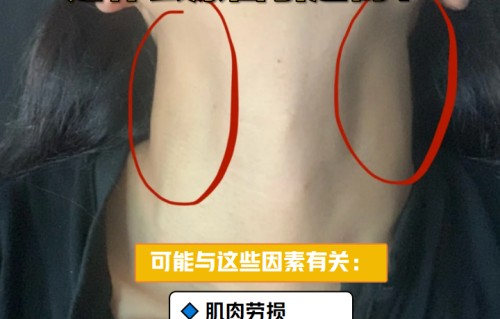 脖子后面长痘痘怎么回事(脖子下起痘痘是怎么回事)