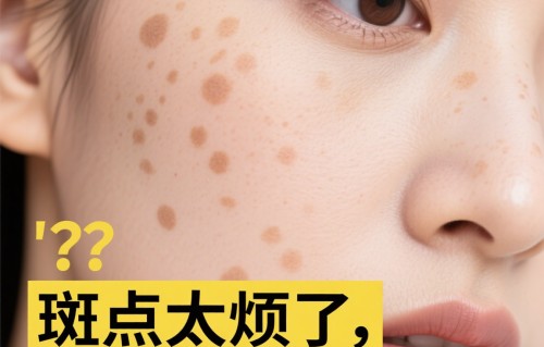 为什么明星不激光祛斑(激光祛斑20天变化图片)