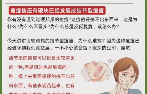 痘痘怎么快速消除(鼻子两侧长痘痘怎么快速消除)