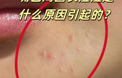 嘴巴周围长痘痘(嘴巴周围长痘痘是什么火)