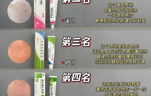 祛斑药膏哪个效果好(激光祛斑20天变化图片)