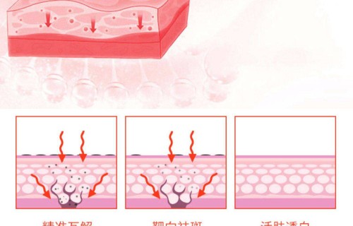 如何美白祛斑(哪个医院祛斑做的最好)