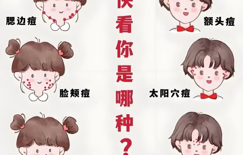 太阳穴长痘痘什么原因(如何养成无痘肌肤)