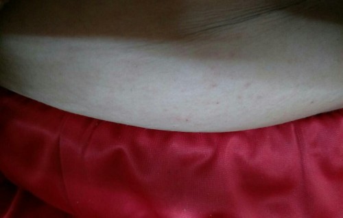 胸口长红色的小痘痘(胸口长红色的小痘痘用什么涂)