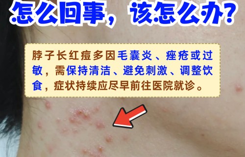 脖子上长痘痘是怎么回事(脖子上起小痘痘是怎么回事)