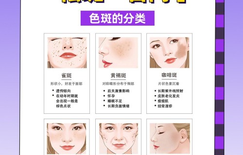 祛斑加盟排名第一(祛斑加盟排名第一牌子)