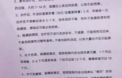 激光可以祛斑吗(激光可以祛斑吗还会复发吗)