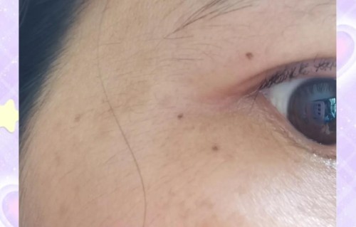 凡士林可以祛斑吗(凡士林可以祛斑吗有效果吗)