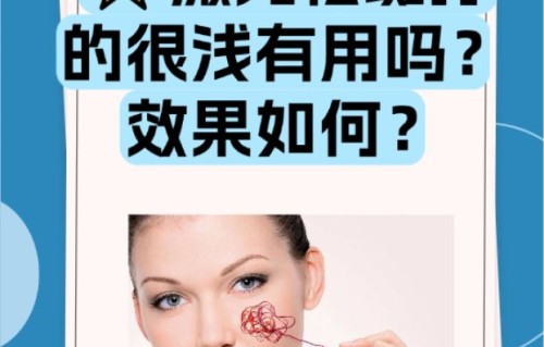 激光祛斑疼吗(激光祛斑一次能干净吗)