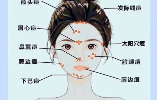 额头长痘痘什么原因(儿童额头长痘痘什么原因)