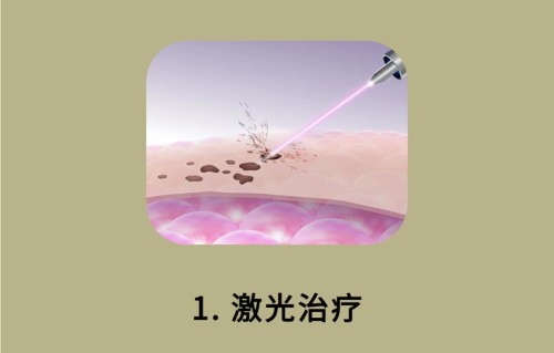 激光祛斑的危害与效果(激光祛斑的危害与效果全过程视频)