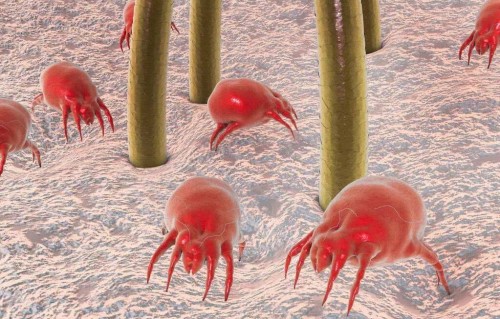 痘痘挤出来的白色东西是什么(身上出现痘痘能挤出白点)