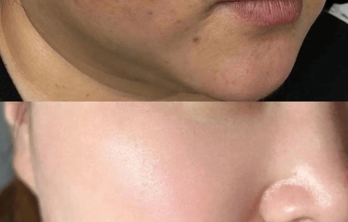 祛斑美白(祛斑美白的中药材有哪些)