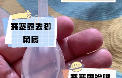 开塞露可以祛斑吗(红霉素软膏加开塞露可以祛斑吗)