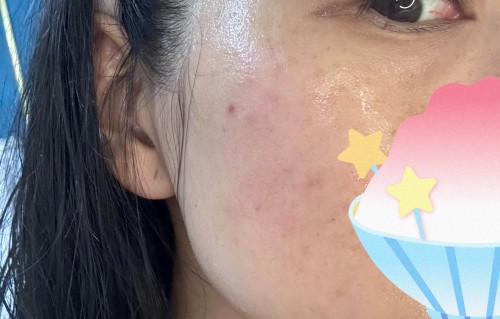 祛斑面膜(祛斑面膜能去掉斑吗)