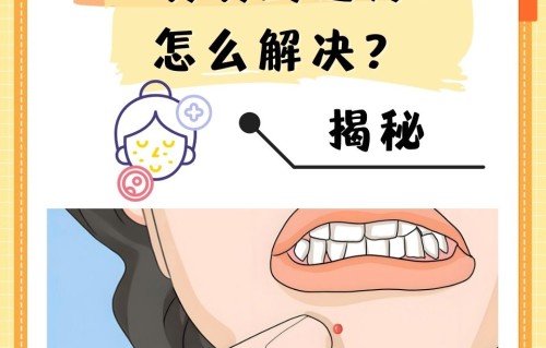 下巴长痘痘的原因(月经前一周下巴长痘痘的原因)