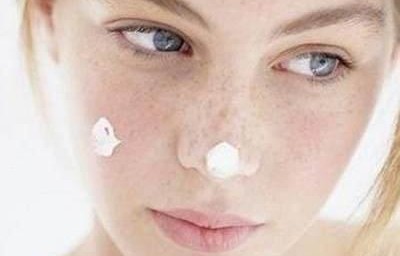 牙膏祛斑(牙膏祛斑法)