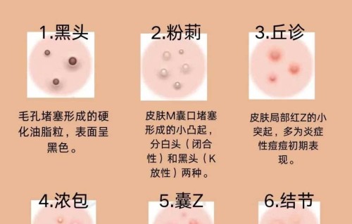 唇周围长痘痘是什么原因(男生唇周围长痘痘是什么原因)