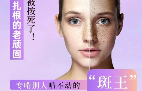 祛斑哪家好(祛斑效果哪家强)