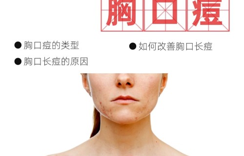 艾滋病胸前长痘痘图片(扫一扫识别皮肤病拍照)