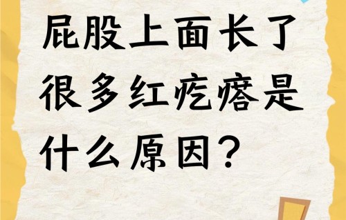 屁股长痘痘是什么原因(屁股长痘痘是什么原因引起的)