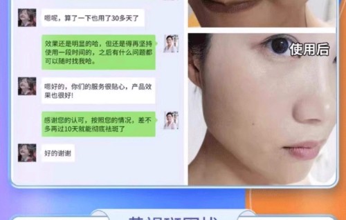 皮肤祛斑多少钱(祛斑美肤要多少钱)