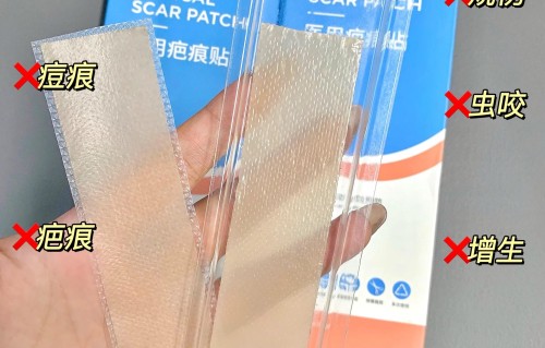 痘痘贴有用吗(壬二酸痘痘贴有用吗)