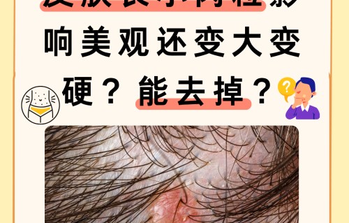 头发里面长痘痘是怎么回事(头发里面长痘痘是怎么回事一碰特疼)