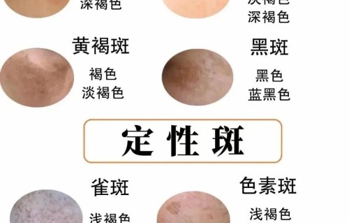 正规医院祛斑多少钱(肌本百颜是正规公司吗)