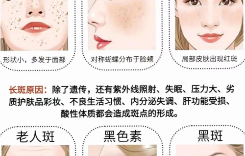 祛斑妙招(祛斑妙招绝招第一名)