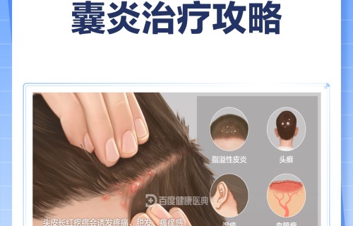 头上长痘痘怎么治疗(头上长痘痘怎么根治)