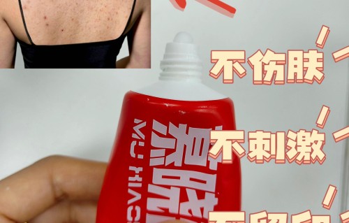 脸上长红色的痘痘是什么原因(脸上长红色的痘痘是什么原因中医)