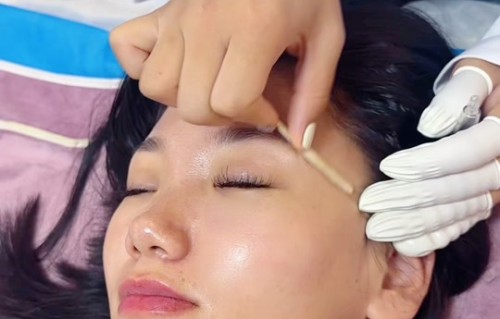 美容院祛斑(美容院祛斑失败可以投诉吗)