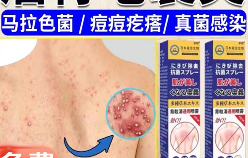 背上长痘痘怎么办(吃避孕药背上长痘痘怎么办)