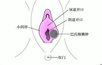 女生下面长痘痘(女生下面长痘痘怎么回事)