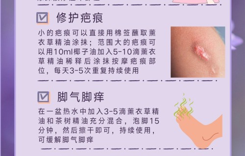 薰衣草精油祛斑方法(薰衣草精油祛斑方法视频)