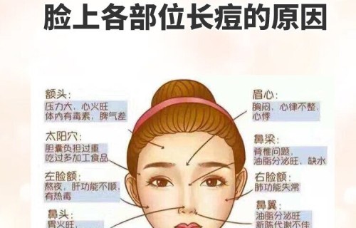 左脸长痘痘是什么原因(左脸长痘什么原因及调理)